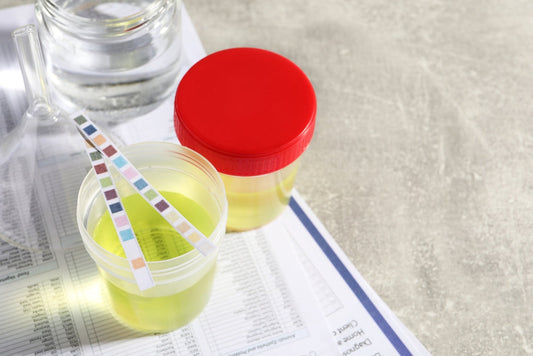 DUTCH Hormone Test: What It Is & What It Reveals